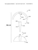 Arthroplasty Instruments and Associated Method diagram and image