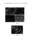 DEVICES FOR ADAPTING BONE diagram and image