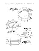 Polyaxial bone anchor having an open retainer with conical, cylindrical or     curvate capture diagram and image