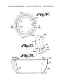 Polyaxial bone anchor having an open retainer with conical, cylindrical or     curvate capture diagram and image