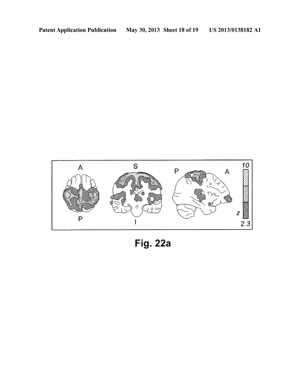 DEVICE AND METHOD FOR ALTERING NEUROTRANSMITTER LEVEL IN BRAIN - diagram, schematic, and image 19