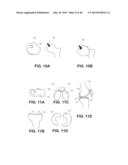 HYDROPHILIC INTERPENETRATING POLYMER NETWORKS DERIVED FROM HYDROPHOBIC     POLYMERS diagram and image