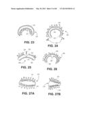 HYDROPHILIC INTERPENETRATING POLYMER NETWORKS DERIVED FROM HYDROPHOBIC     POLYMERS diagram and image