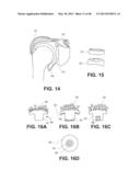 HYDROPHILIC INTERPENETRATING POLYMER NETWORKS DERIVED FROM HYDROPHOBIC     POLYMERS diagram and image