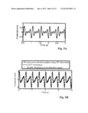 WAVELENGTH DIVISION SENSING RF VIBROMETER FOR ACCURATE MEASUREMENT OF     COMPLEX VIBRATIONS diagram and image