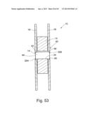 Torsion Vibration Damper Assembly And Vibration Damper Device, In     Particular In A Torsion Vibration Damper Assembly diagram and image