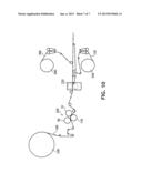 Extensible Absorbent Layer And Absorbent Article diagram and image