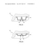 SELECTIVELY DISENGAGABLE SEALING SYSTEM diagram and image