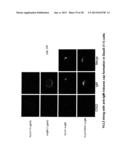 Therapeutic Use of Anti-CD22 Antibodies for Inducing Trogocytosis diagram and image