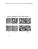 METHODS OF TREATMENT USING STERCULIC ACID diagram and image