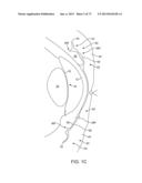 OCULAR INSERT APPARATUS AND METHODS diagram and image