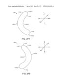 OCULAR INSERT APPARATUS AND METHODS diagram and image