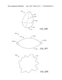 OCULAR INSERT APPARATUS AND METHODS diagram and image