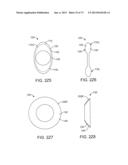 OCULAR INSERT APPARATUS AND METHODS diagram and image