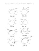 OCULAR INSERT APPARATUS AND METHODS diagram and image