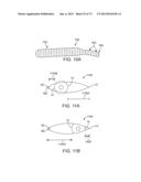 OCULAR INSERT APPARATUS AND METHODS diagram and image