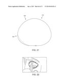 OCULAR INSERT APPARATUS AND METHODS diagram and image