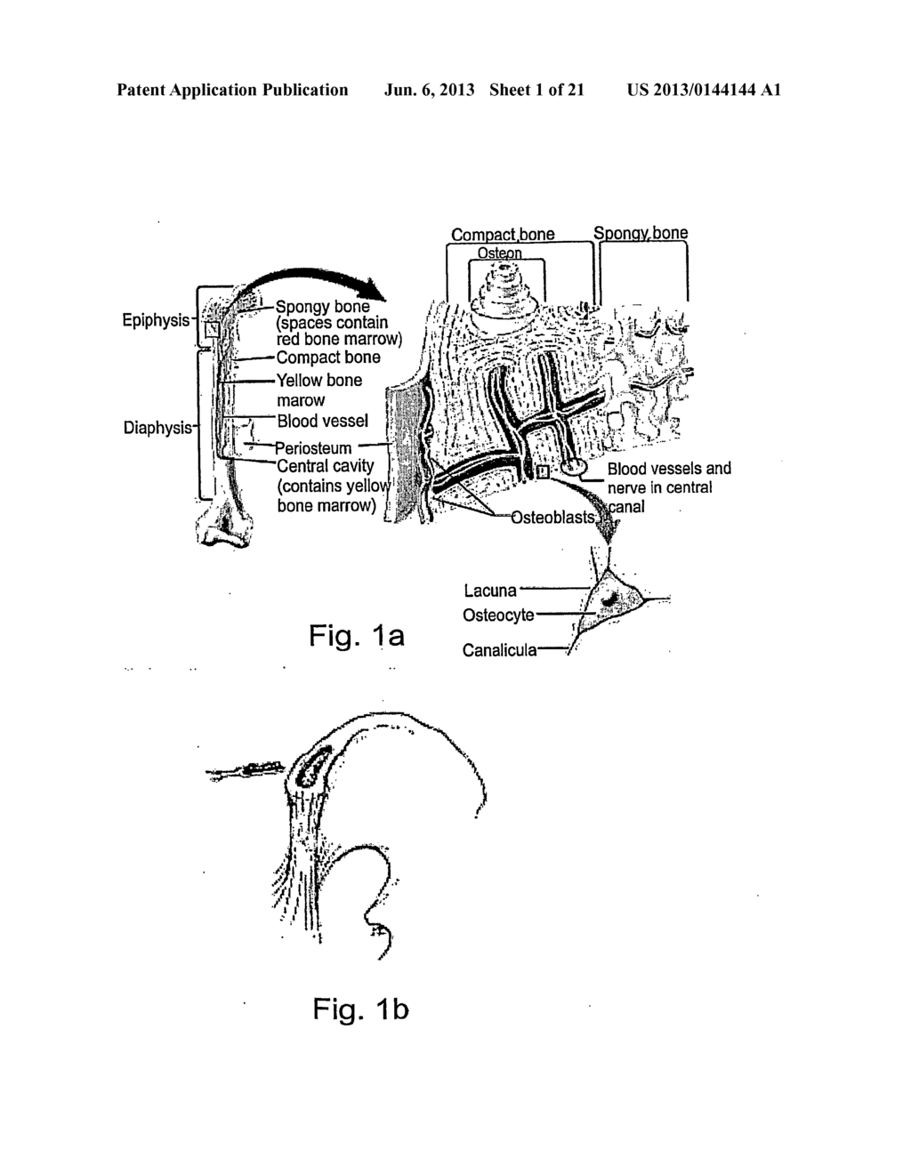 DEVICE SYSTEM AND METHOD FOR MONITORING AND CONTROLLING BLOOD ANALYTE     LEVELS - diagram, schematic, and image 02