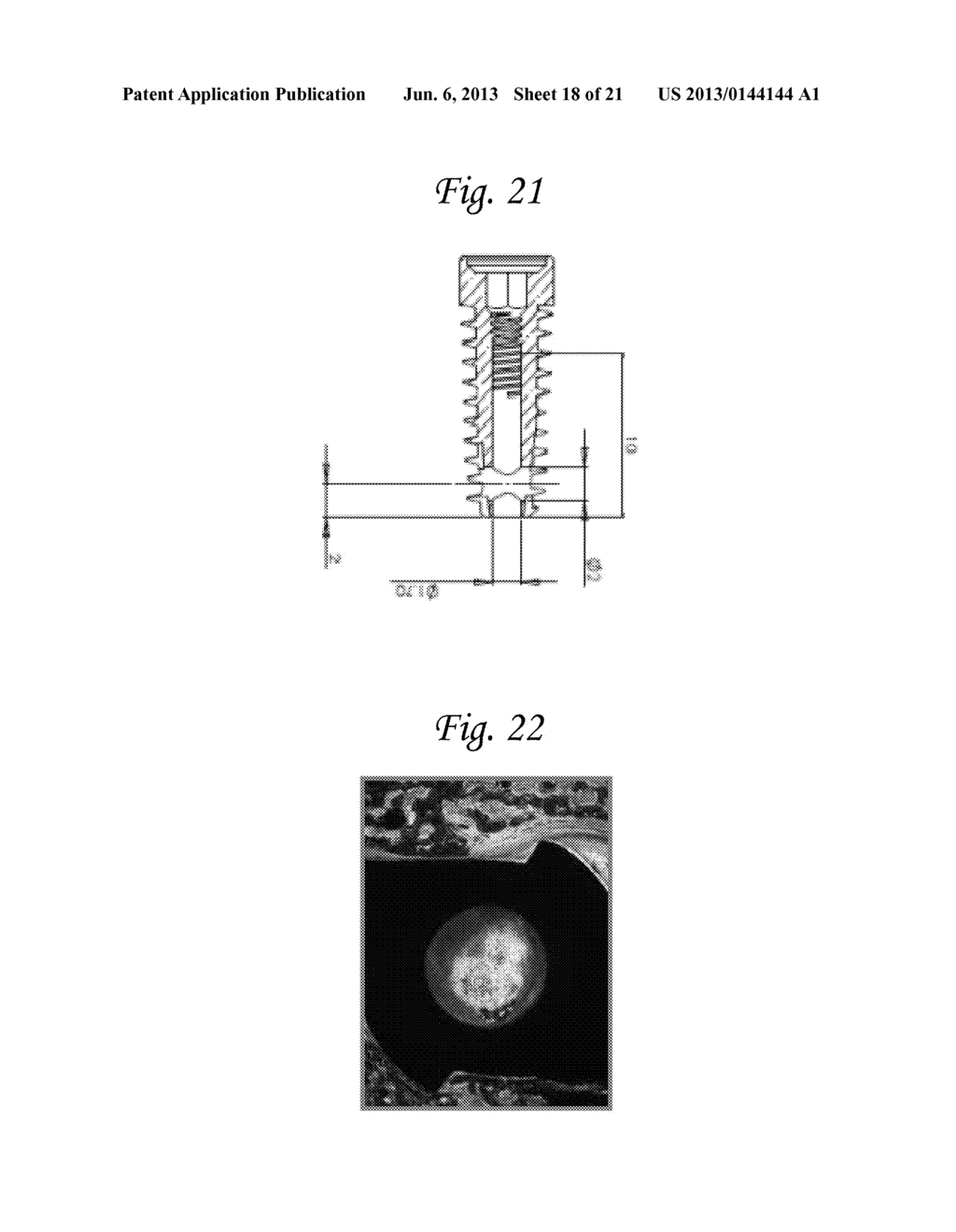 DEVICE SYSTEM AND METHOD FOR MONITORING AND CONTROLLING BLOOD ANALYTE     LEVELS - diagram, schematic, and image 19