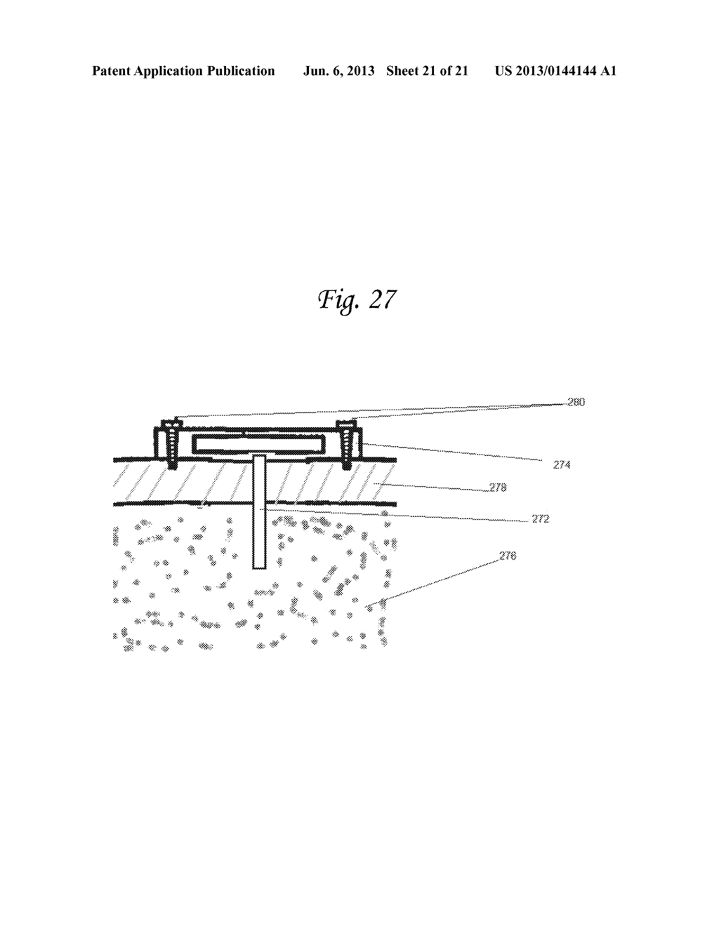 DEVICE SYSTEM AND METHOD FOR MONITORING AND CONTROLLING BLOOD ANALYTE     LEVELS - diagram, schematic, and image 22