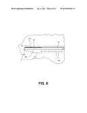 PORTABLE FEMALE URINE COLLECTOR FOR URINE COLLECTION AND STOWAGE AND     METHOD OF ASSEMBLING SAME diagram and image