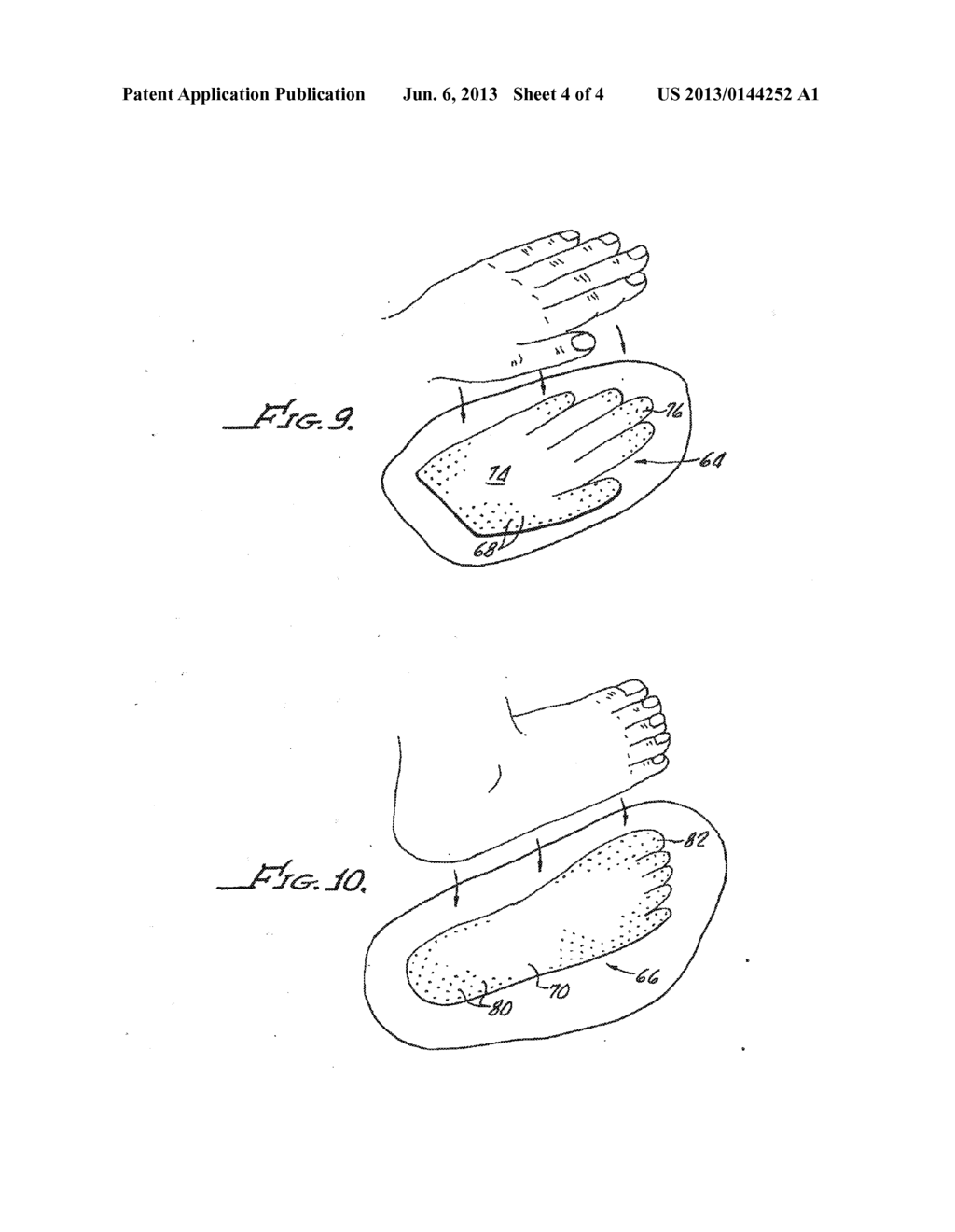 NEEDLESS MICROPROTRUSION ELASTOPLAST SYSTEM - diagram, schematic, and image 05