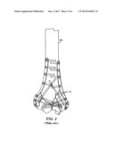 FRACTURE FIXATION SYSTEM diagram and image