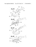 Skin Tensioner for Hair Transplantation diagram and image