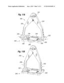 Skin Tensioner for Hair Transplantation diagram and image