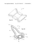 Skin Tensioner for Hair Transplantation diagram and image