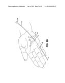 METHOD AND APPARATUS FOR REPAIRING A TENDON OR LIGAMENT diagram and image