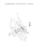 METHOD AND APPARATUS FOR REPAIRING A TENDON OR LIGAMENT diagram and image