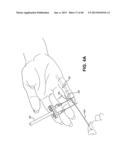 METHOD AND APPARATUS FOR REPAIRING A TENDON OR LIGAMENT diagram and image