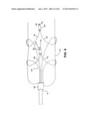 METHOD AND APPARATUS FOR REPAIRING A TENDON OR LIGAMENT diagram and image