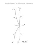 METHOD AND APPARATUS FOR REPAIRING A TENDON OR LIGAMENT diagram and image