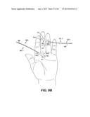 METHOD AND APPARATUS FOR REPAIRING A TENDON OR LIGAMENT diagram and image