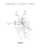 METHOD AND APPARATUS FOR REPAIRING A TENDON OR LIGAMENT diagram and image