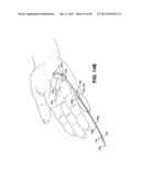 METHOD AND APPARATUS FOR REPAIRING A TENDON OR LIGAMENT diagram and image