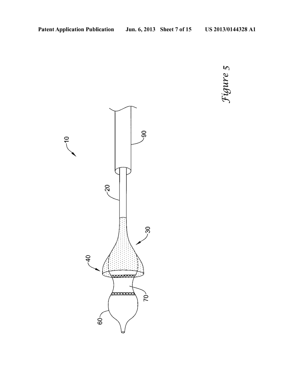 EXPANDING DISTAL SHEATH WITH COMBINED EMBOLIC PROTECTION - diagram, schematic, and image 08