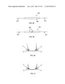 METHOD AND APPARATUS FOR ATTACHING SOFT TISSUE TO BONE diagram and image