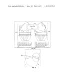 Method of and System for Planning a Surgery diagram and image