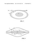 INTRODUCTION OF IONS INTO KINGDON ION TRAPS diagram and image