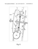 Magnetically Assisted Kinetic Turbine System diagram and image