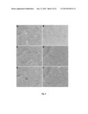 p19Arf, HMGA2 and MDM2 For Use in the Diagnosis and Treatment of Aberrant     Cell Growth diagram and image