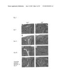 CANDIDATES AGAINST INFECTION diagram and image