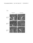 CANDIDATES AGAINST INFECTION diagram and image