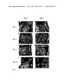 CANDIDATES AGAINST INFECTION diagram and image