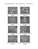 ISOLATED RENAL CELLS AND USES THEREOF diagram and image