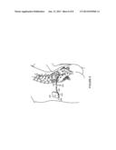 AUXILIARY ELECTRODE FOR LITHIUM-ION BATTERY diagram and image