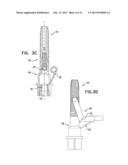 IMPLANT SYSTEMS WITH SWIVEL JOINTS FOR SINUS LIFT AND BONE AUGMENTATION diagram and image